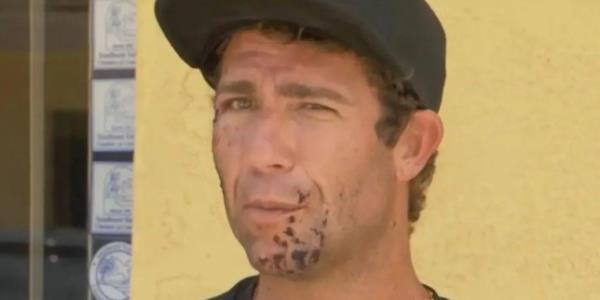 A surfer suffered serious facial injuries when he was chomped on by a shark in Florida, USA (Picture: WESH) 