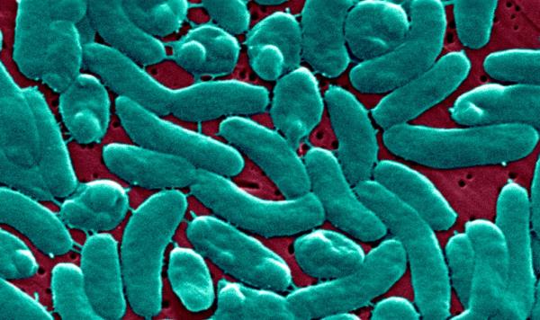 This Scanning Electron Micrograph Sem Depicts A Grouping Of Vibrio Vulnificus Bacteria; Mag. 13184X. Vibrio Vulnificus Is A Bacterium In The Same Family As Those That Cause Cholera.
