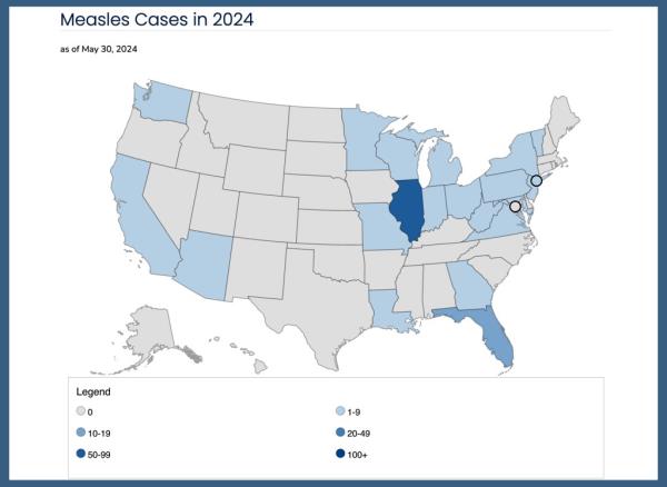 A map of measles cases.