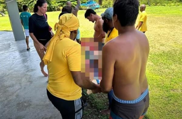 The teen being carried by rescuers. Her leg is blurred out.
