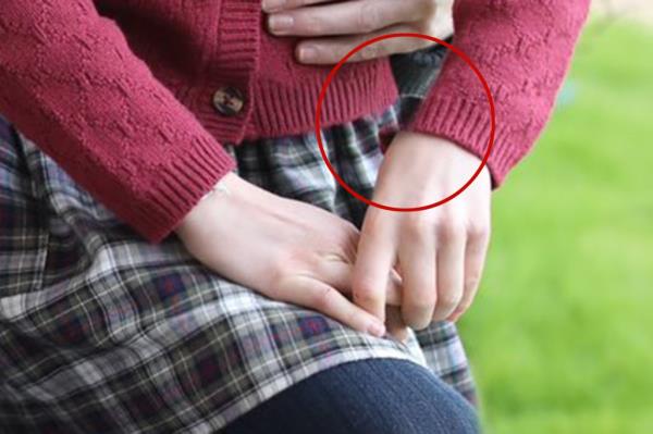 Princess Charlotte appears to be missing a part of her wrist in the image