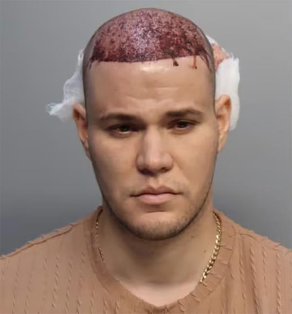 Eugenio Ernesto Hernandez-Garnier, 27,