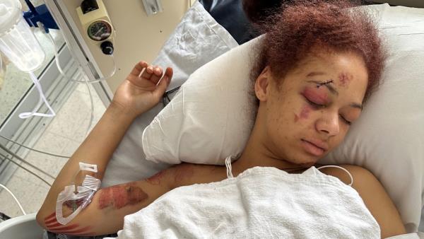 Holycross in the hospital bed.