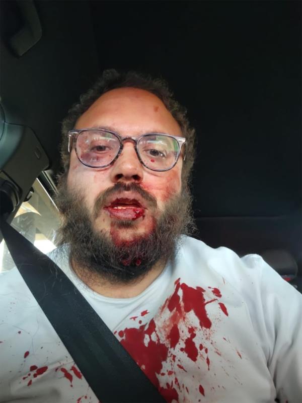 A CBZ Management employee is seen bloodied after a brutal assault at one of the company's apartments in Aurora.