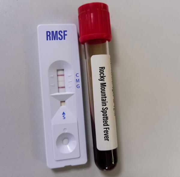 Symptoms can at first appear mild over the first 1-4 days of infection, including a “low-moderate fever, headache, gastrointestinal symptoms, abdominal pain, myalgia, rash, and edema around the eyes and on the back of hands,” the notice says.