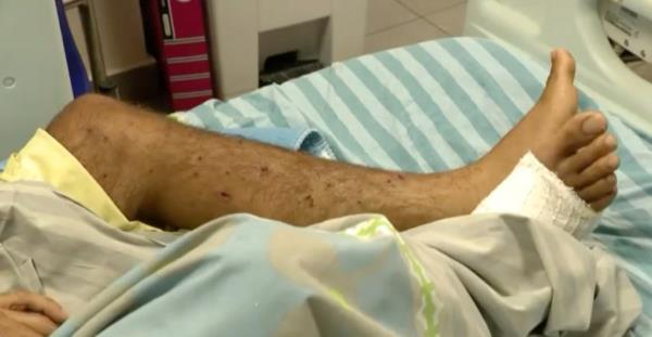 A close up of Raz Peri's legs shows one leg with small wounds and the other, which has a cast on it, under bedclothes.