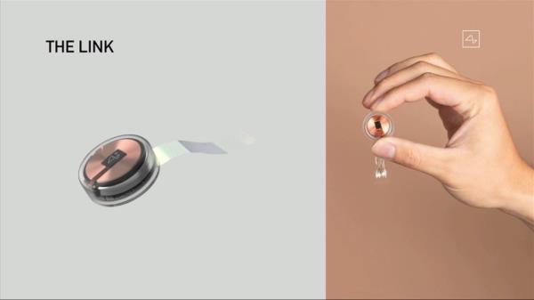 Elon Musk announced that the first human has been implanted with a Neural<em></em>ink brain-chip.