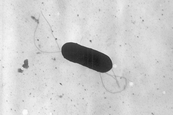 This 2002 electron microscope image made available by the Centers for Disease Co<em></em>ntrol and Prevention shows a Listeria mo<em></em>nocytogenes bacterium. 