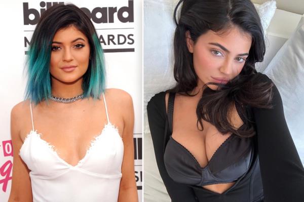 (Left) Kylie Jenner pre-breast augmentation surgery at the Billboard Music Awards. (Right) Kylie Jenner laying on a bed in a black bra. 