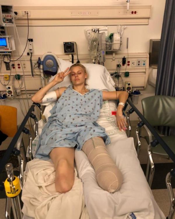 The doctors were able to save her life but sadly her lower legs were irreparable and she needed to have them amputated.</p>
<p>