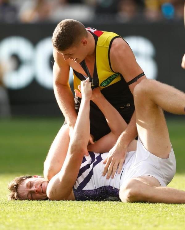 Jye Amiss copped a knee to the face late in the game.